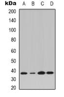 NFKBIA / IKB Alpha / IKBA Antibody (N-Terminus)