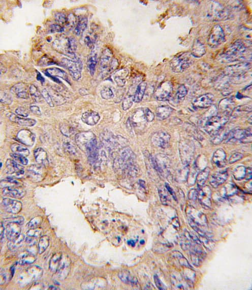 Polyclonal Rabbit anti-Human TRAF2 Antibody (aa343-372, IHC, WB)