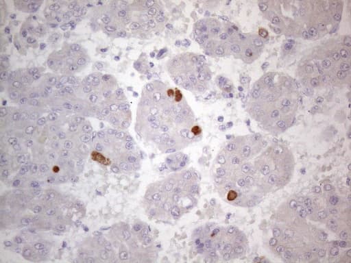 Monoclonal Mouse anti-Human TTC14 Antibody (clone OTI9E11, aa429-770, IHC, WB)