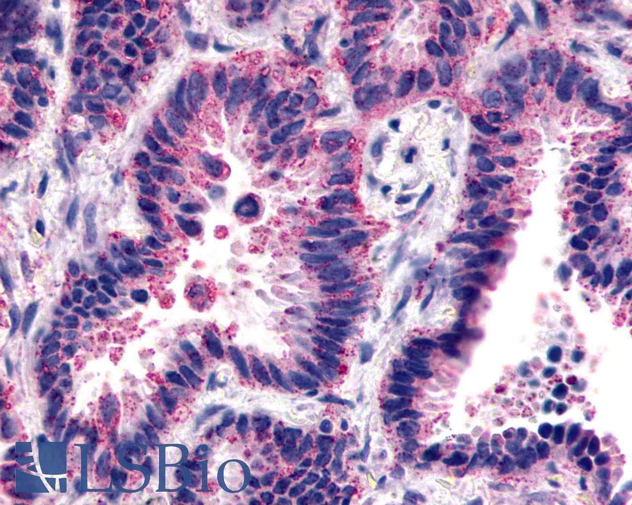 IHC-plus™ FZD2 / Frizzled 2 Antibody (Extracellular Domain)