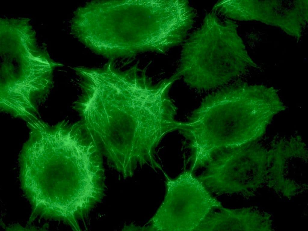 PathPlus™ KRT17 / CK17 / Cytokeratin 17 Antibody (clone E3)
