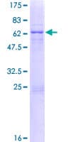 Human ZC3H14 Protein (Recombinant GST)