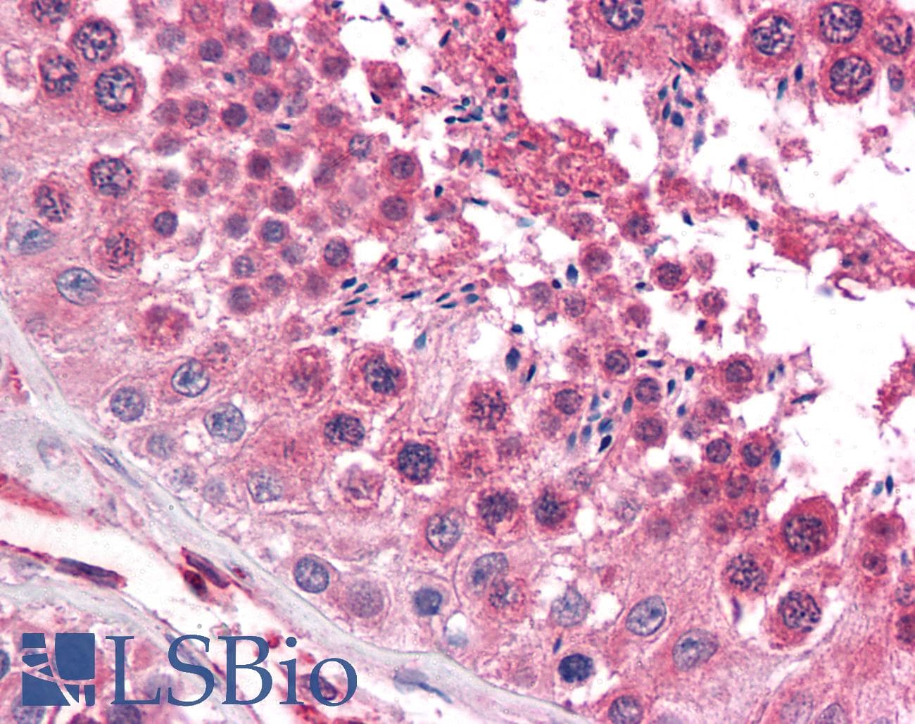 IHC-plus™ SRPK1 Antibody (clone 6H5)