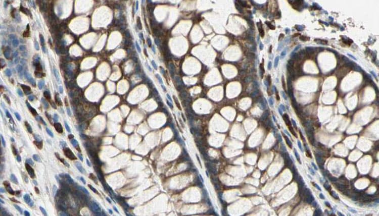 SAG / Arrestin Antibody