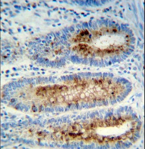 MPO / Myeloperoxidase Antibody (aa420-448)