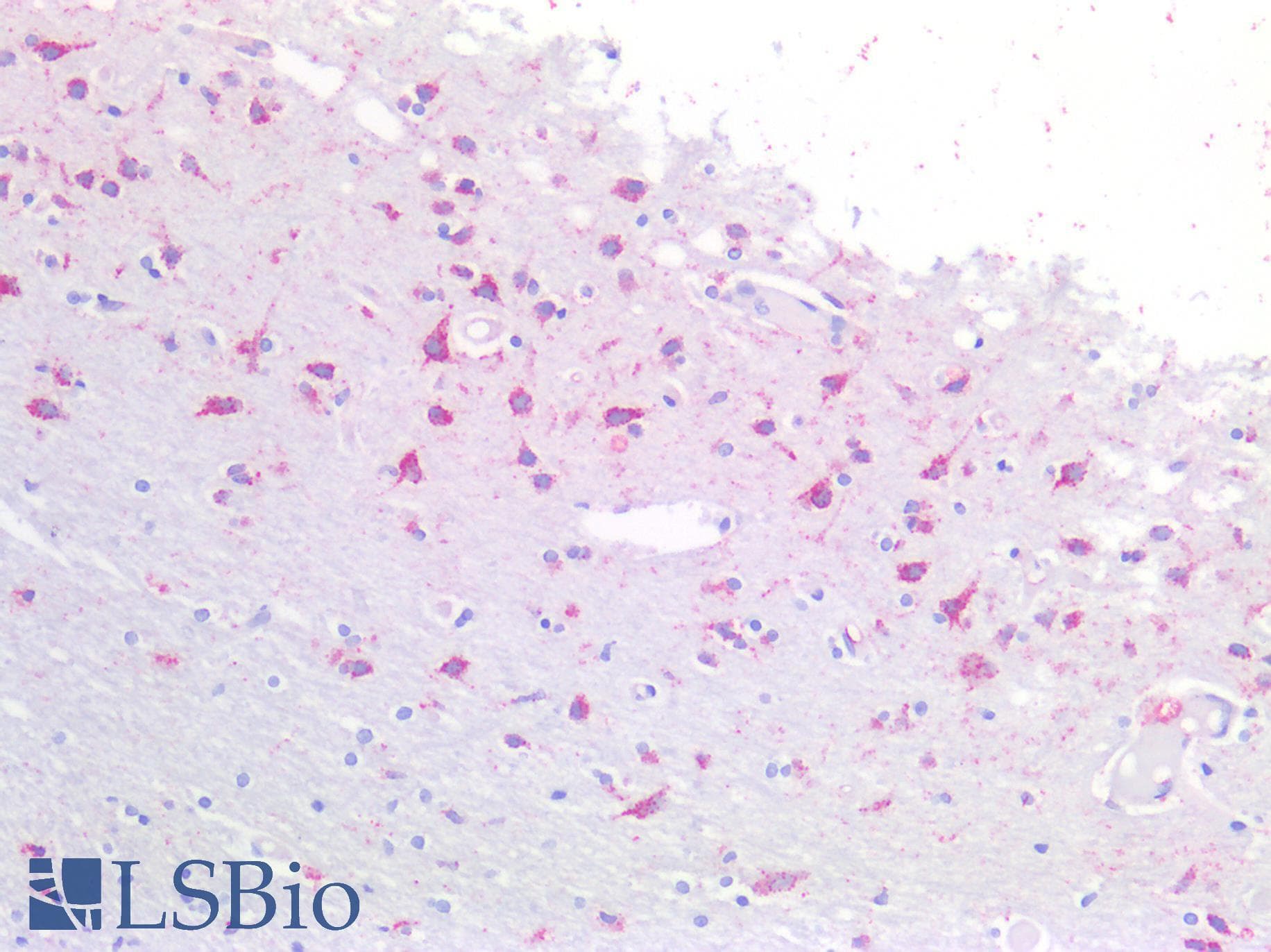 IHC-plus™ CTSB / Cathepsin B Antibody