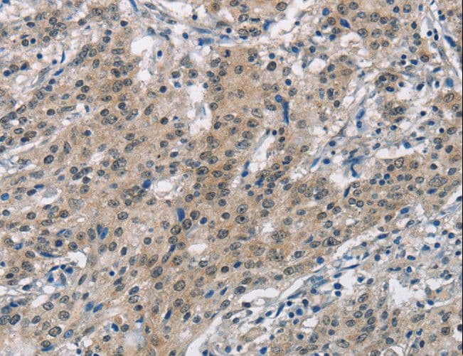 SMAD9 Antibody