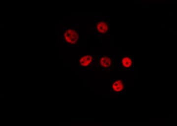 SF3B4 Antibody