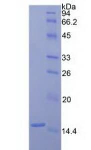 Rat F7 / Factor VII Protein (Recombinant His)
