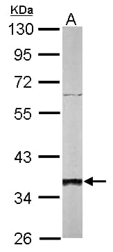 SGTA / SGT Antibody (aa6-313)