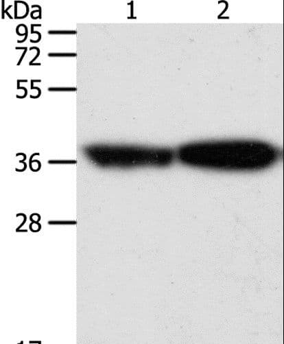 TPM2 Antibody
