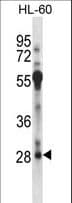 RFXAP Antibody (aa196-225)