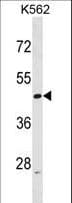 BAF53 / ACTL6A Antibody (aa2-30)