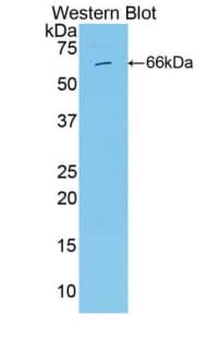 ITGB2 / CD18 Antibody (aa451-627, APC)