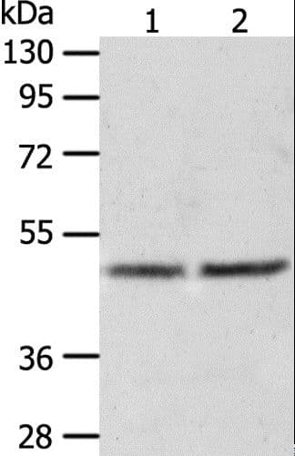 AGXT / SPT Antibody