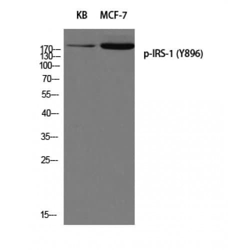 Polyclonal Rabbit anti-Human IRS1 Antibody (840-920 aa, WB)