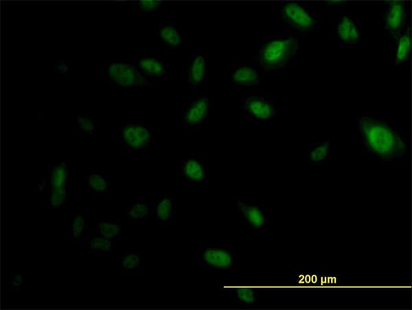IHC-plus™ EP300 / p300 Antibody (clone 1D2)