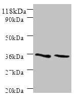 IHC-plus™ Polyclonal Rabbit anti-Human SNX20 Antibody (aa 1-102, IHC, WB)
