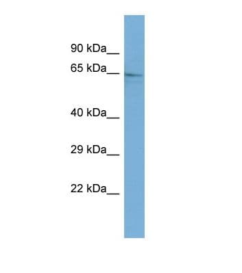 GALNT9 Antibody (aa426-475)
