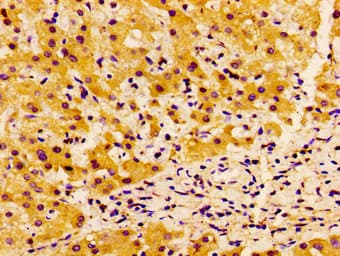 Polyclonal Rabbit anti-Human SSX2IP Antibody (IHC, IF, WB)