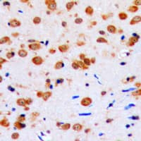 Polyclonal Rabbit anti-Human AKT1 Antibody (N-Terminus, IHC, WB)