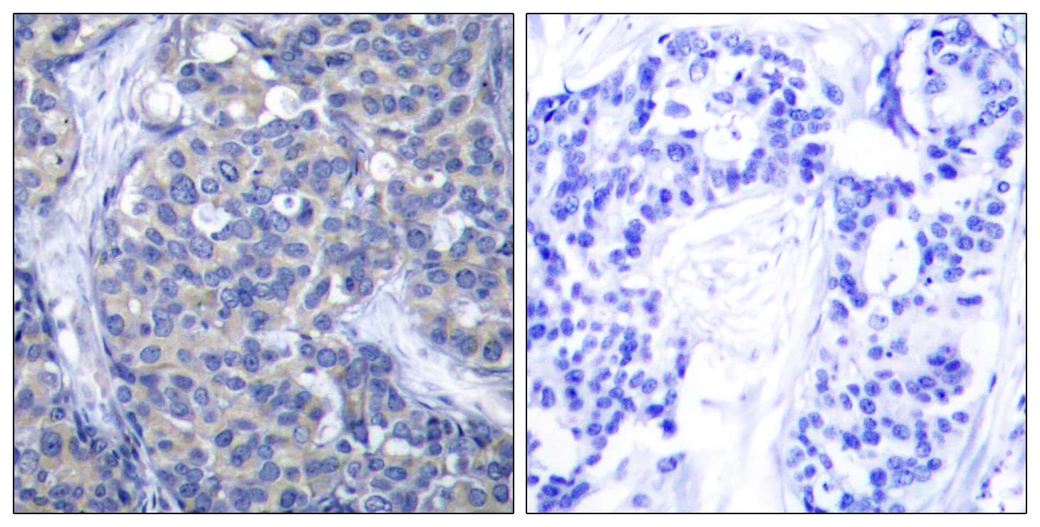 ZAP70 Antibody (aa286-335)