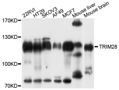 TRIM28 / KAP1 Antibody