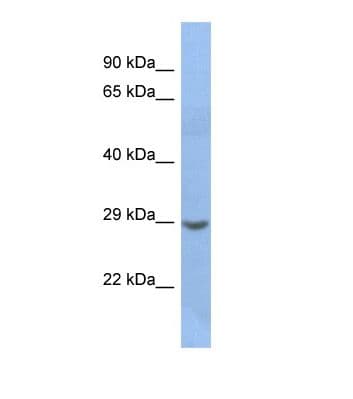 NKX2-2 Antibody (aa89-138)
