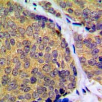 MAP2K2 / MKK2 / MEK2 Antibody (phospho-Thr394)