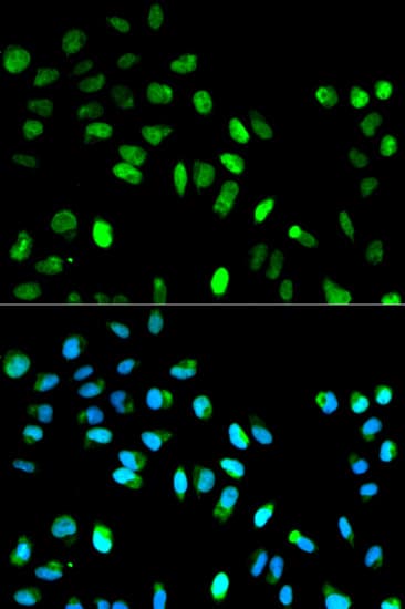 MAD1L1 / MAD1 Antibody