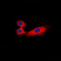 RPH3A / Rabphilin 3A Antibody (Internal)