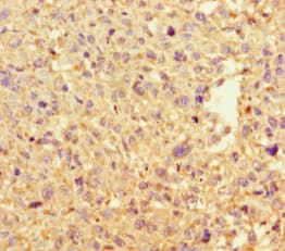 DAAM2 Antibody