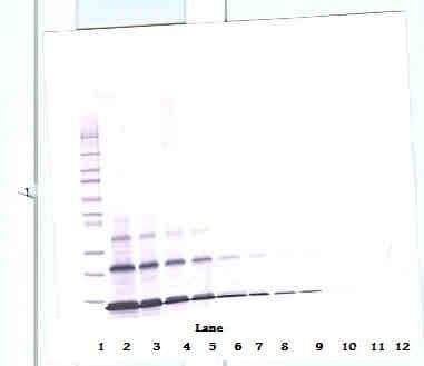 PTHLH / PTHRP Antibody