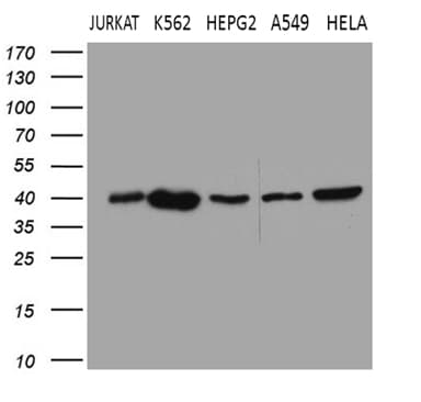 L3 / LASS2 Antibody (aa62-136, clone OTI3D9)