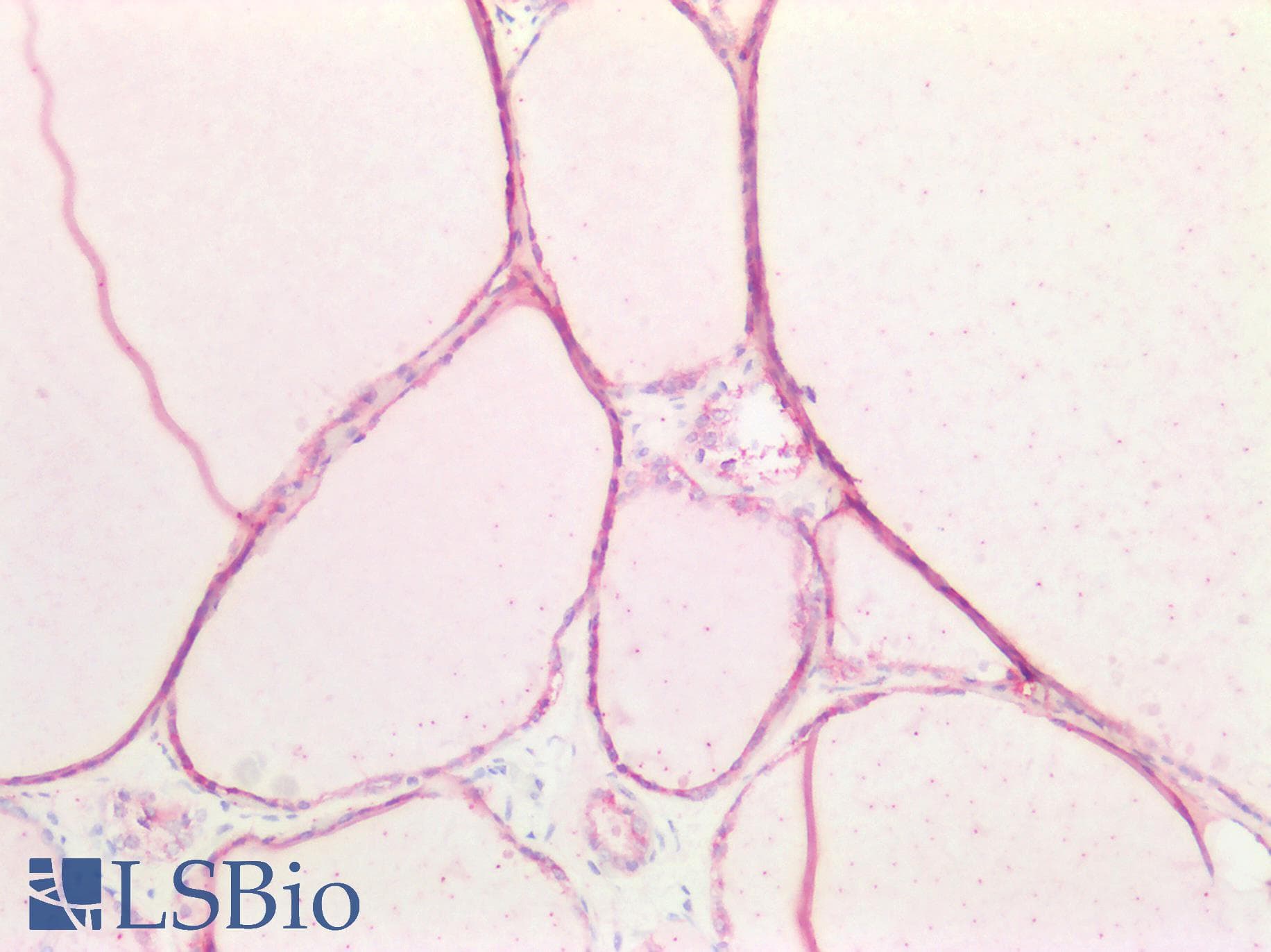 PathPlus™ CDH16 / Cadherin 16 Antibody (aa19-230)