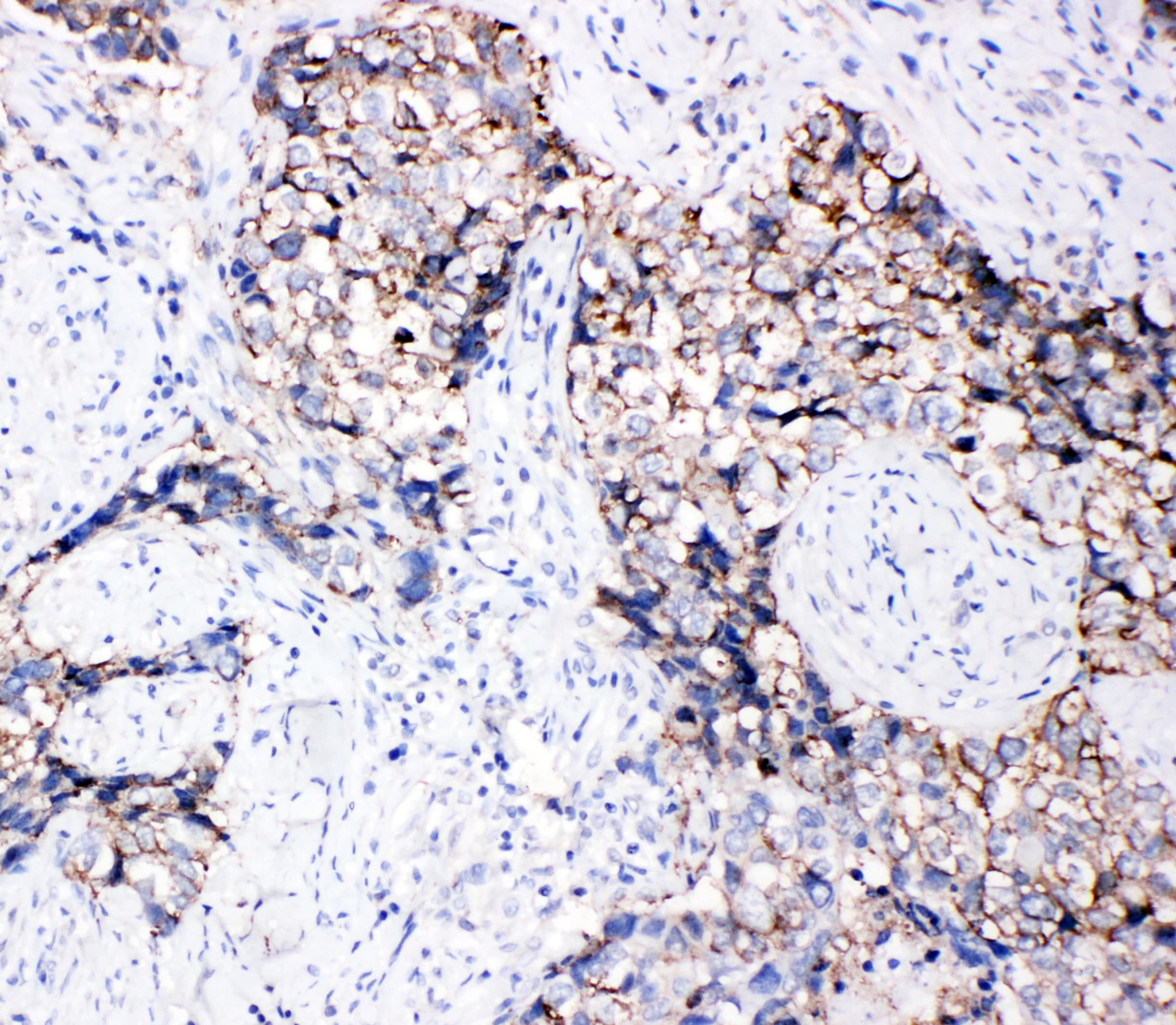 Polyclonal Rabbit anti-Human EPHB3 / EPH Receptor B3 Antibody (aa982-998, IHC, WB)