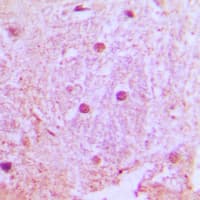Polyclonal Rabbit anti-Human UBTD1 Antibody (Internal, IHC, WB)