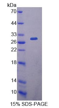 Mouse CBR / CBR1 Protein (Recombinant His-T7)