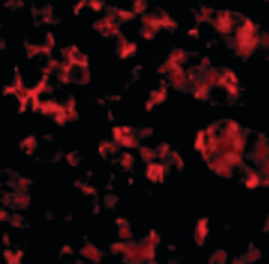 IHC-plus™ Polyclonal Rabbit anti-Human TRIM5 Antibody (IHC, IF, WB)