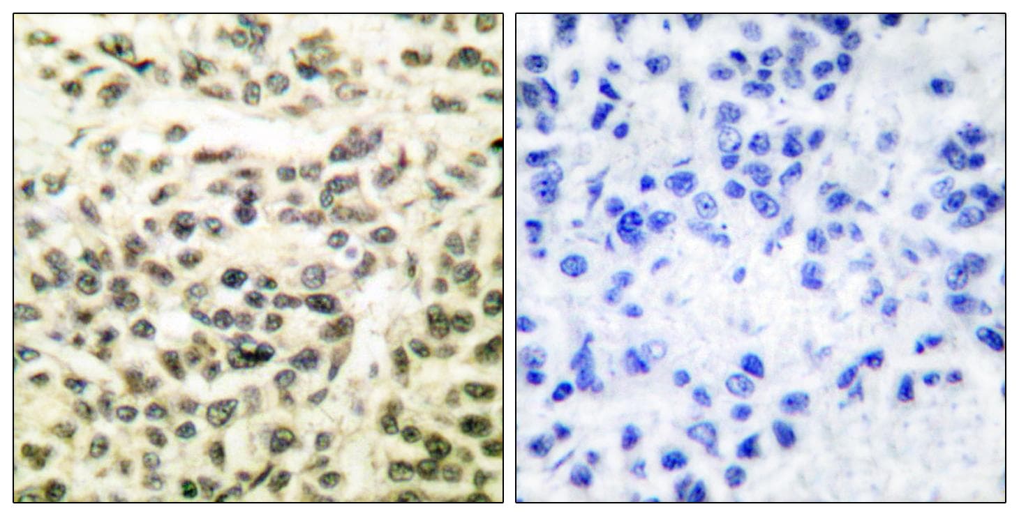 Polyclonal Rabbit anti-Human GSK3A / GSK3 Alpha Antibody (p279/216, IHC, WB)