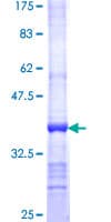 Human ALAS2 Protein (Recombinant GST, N-terminus)