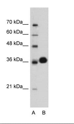Polyclonal Rabbit anti-Human CDK6 Antibody (HRP, C-Terminus, WB)