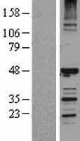 HERPUD1 / HERP Protein (Over-Expression Lysate Myc-DDK (Flag))