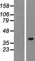 PTF1A Protein (Over-Expression Lysate Myc-DDK (Flag))