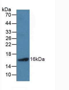 NPPB / BNP Antibody