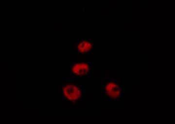 CHEK2 / CHK2 Antibody (phospho-Ser516)