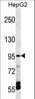 Polyclonal Rabbit anti-Human ECaC / TRPV5 Antibody (aa634-663, WB)