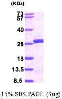 Human NUDT21 Protein (Recombinant His)