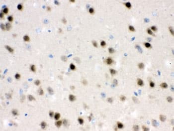 HDAC11 Antibody