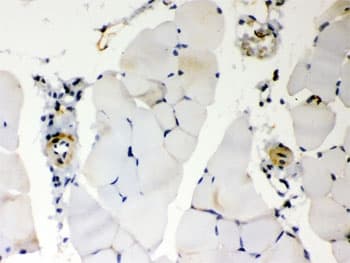BAK1 / BAK Antibody
